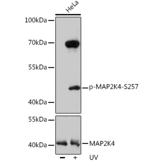 Phospho-MAP2K4-S257 Rabbit Polyclonal Antibody