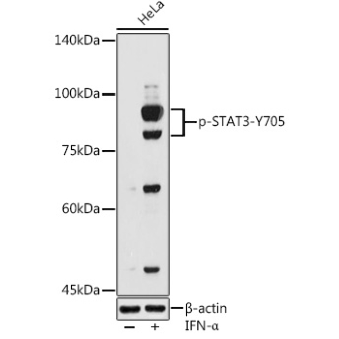 Phospho-STAT3-Y705 Rabbit Polyclonal Antibody