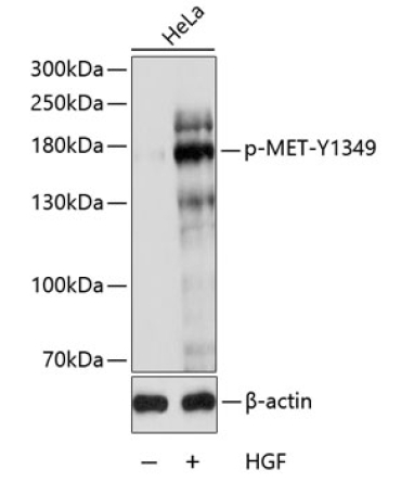 Phospho-MET-Y1349 Rabbit Polyclonal Antibody