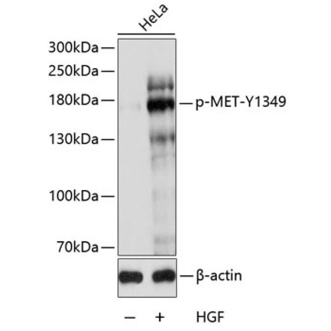 Phospho-MET-Y1349 Rabbit Polyclonal Antibody