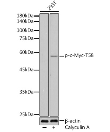 Phospho-c-Myc-T58 Rabbit Polyclonal Antibody