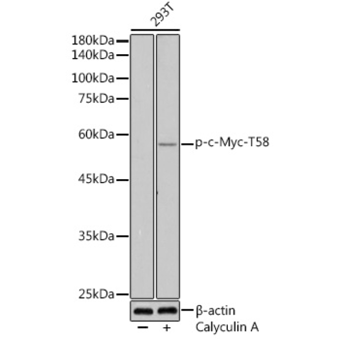 Phospho-c-Myc-T58 Rabbit Polyclonal Antibody