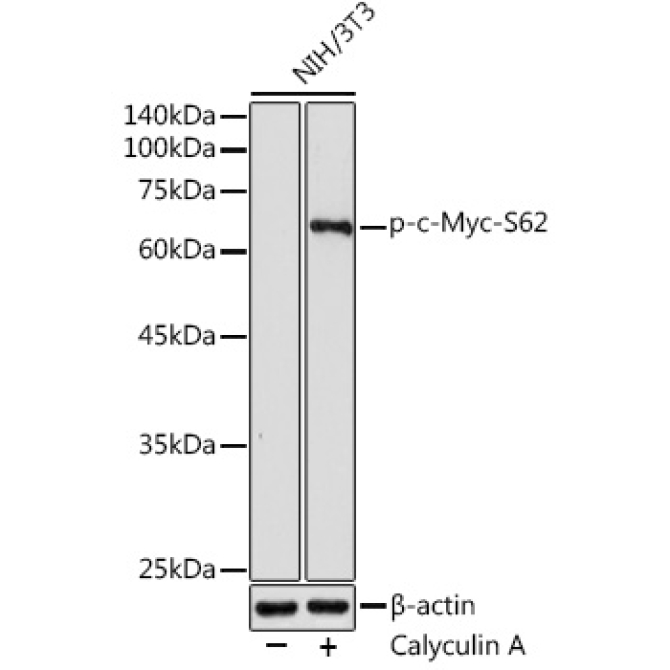 Phospho-c-Myc-S62 Rabbit Polyclonal Antibody