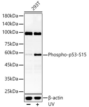 Phospho-p53-S15 Rabbit Polyclonal Antibody
