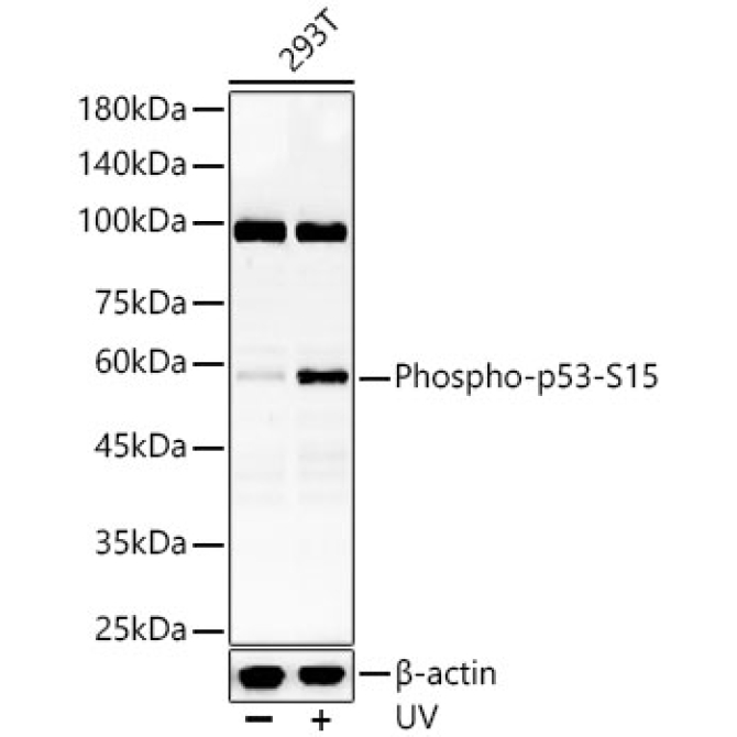 Phospho-p53-S15 Rabbit Polyclonal Antibody