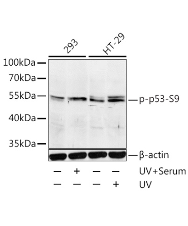 Phospho-p53-S9 Rabbit Polyclonal Antibody