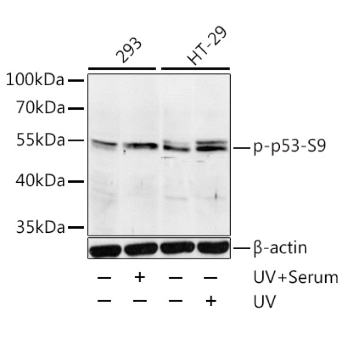 Phospho-p53-S9 Rabbit Polyclonal Antibody