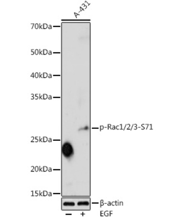 Phospho-Rac1/2/3-S71 Rabbit Polyclonal Antibody