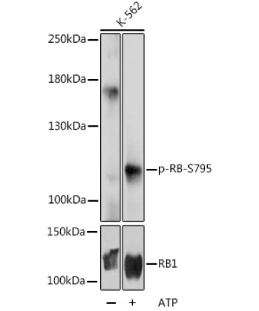 Phospho-RB-S795 Rabbit Polyclonal Antibody