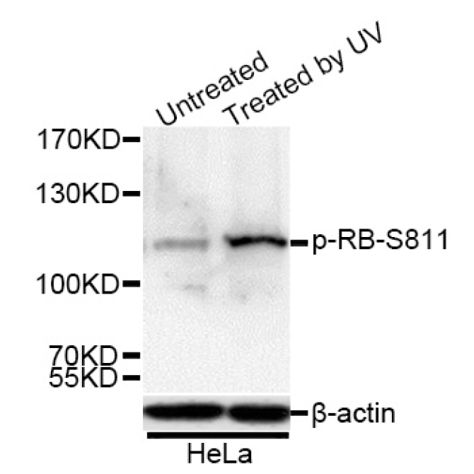 Phospho-RB-S811 Rabbit Polyclonal Antibody