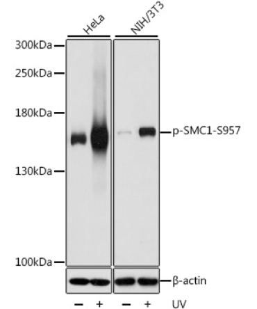 Phospho-SMC1-S957 Rabbit Polyclonal Antibody