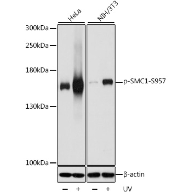 Phospho-SMC1-S957 Rabbit Polyclonal Antibody