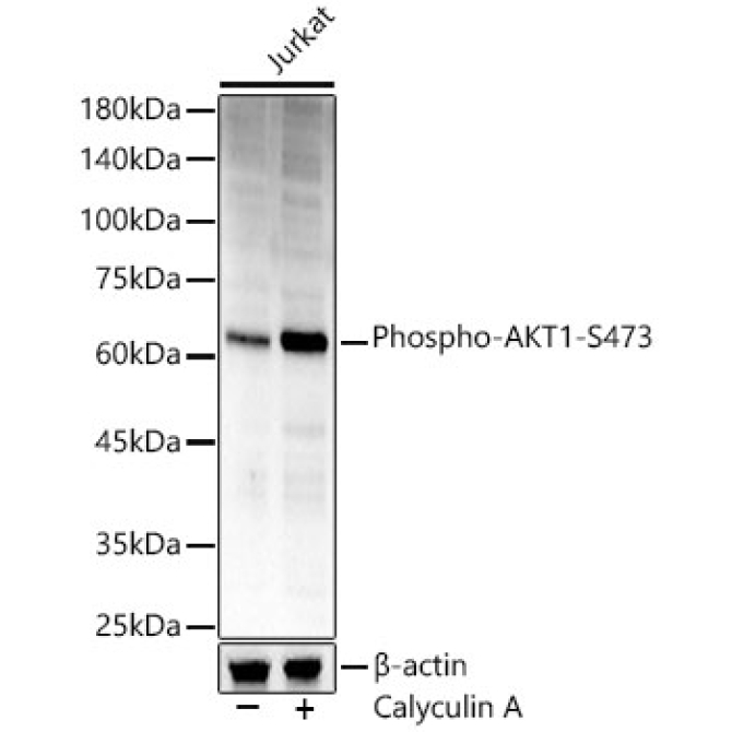 Phospho-AKT1-S473 Rabbit Polyclonal Antibody