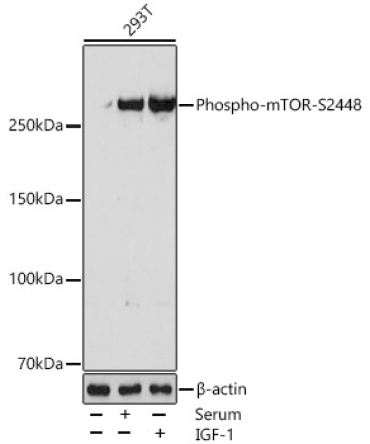 Phospho-mTOR-S2448 Rabbit Monoclonal Antibody