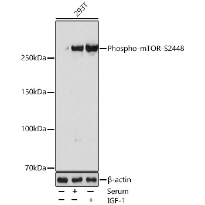 Phospho-mTOR-S2448 Rabbit Monoclonal Antibody