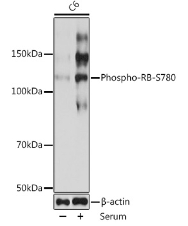 Phospho-RB-S780 Rabbit Monoclonal Antibody