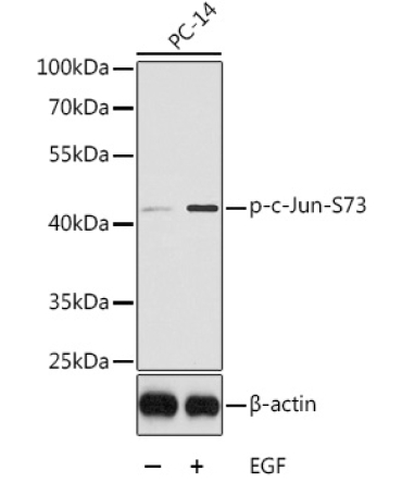 Phospho-c-Jun-S73 Rabbit Polyclonal Antibody