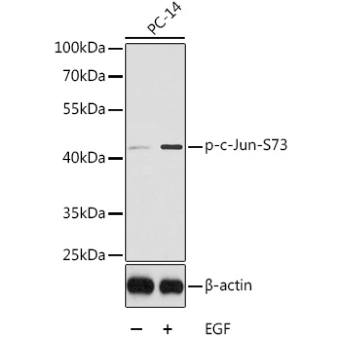 Phospho-c-Jun-S73 Rabbit Polyclonal Antibody