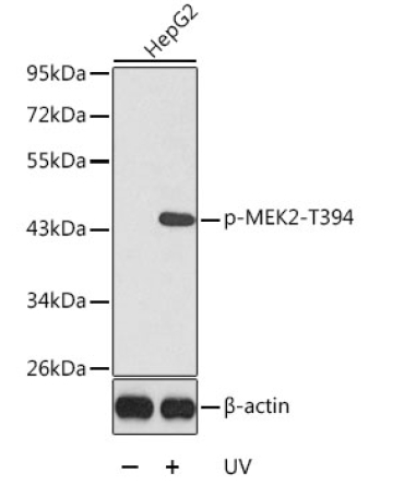 Phospho-MEK2-T394 Rabbit Polyclonal Antibody