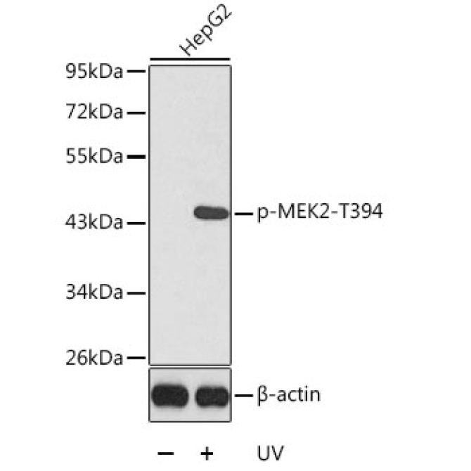 Phospho-MEK2-T394 Rabbit Polyclonal Antibody