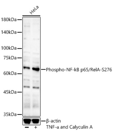 Phospho-NF-kB p65/RelA-S276 Rabbit Polyclonal Antibody