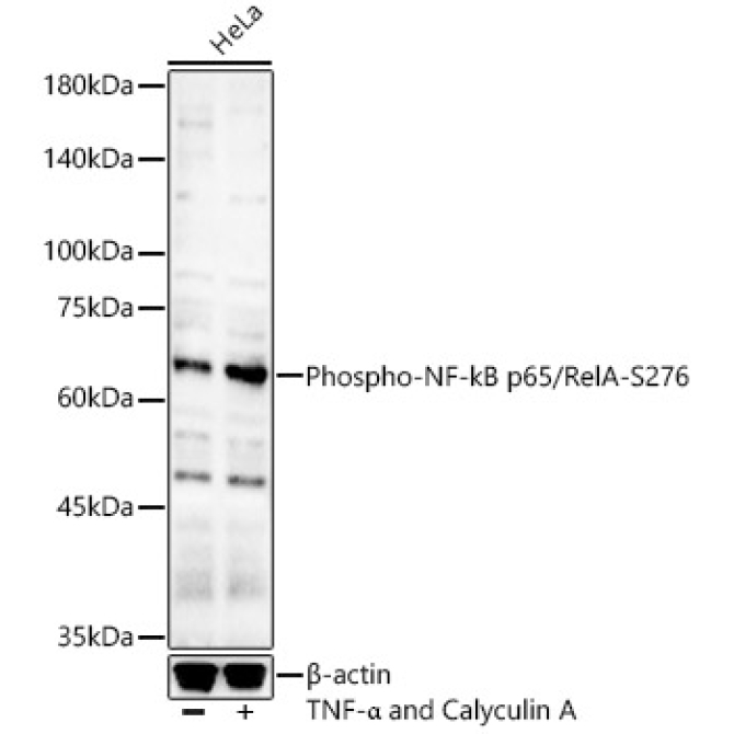 Phospho-NF-kB p65/RelA-S276 Rabbit Polyclonal Antibody