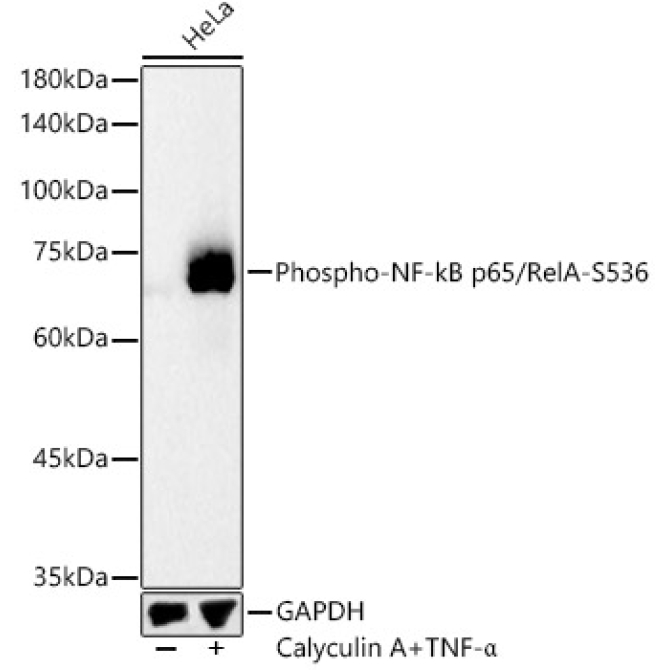 Phospho-NF-kB p65/RelA-S536 Rabbit Polyclonal Antibody