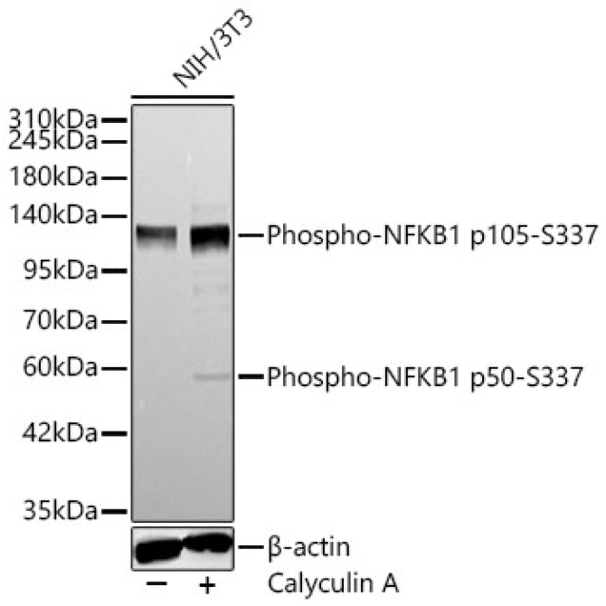 Phospho-NFKB1-S337 Rabbit Polyclonal Antibody