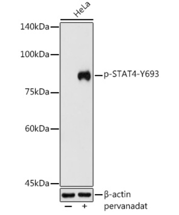 Phospho-STAT4-Y693 Rabbit Polyclonal Antibody