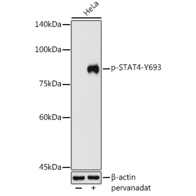 Phospho-STAT4-Y693 Rabbit Polyclonal Antibody
