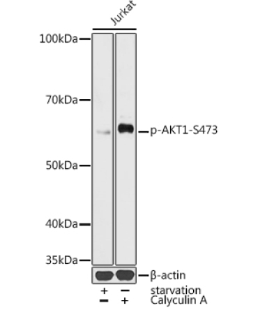Phospho-AKT1-S473 Rabbit Polyclonal Antibody