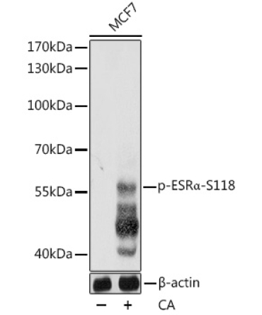 Phospho-ESRAlpha-S118 Rabbit Polyclonal Antibody