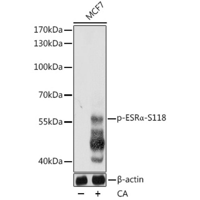 Phospho-ESRAlpha-S118 Rabbit Polyclonal Antibody