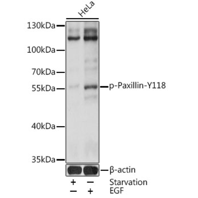 Phospho-Paxillin-Y118 Rabbit Polyclonal Antibody