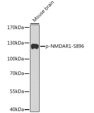 Phospho-NMDAR1-S896 Rabbit Polyclonal Antibody