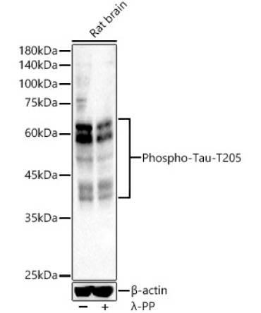 Phospho-Tau-T205 Rabbit Polyclonal Antibody