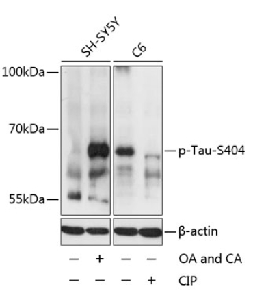 Phospho-Tau-S404 Rabbit Polyclonal Antibody