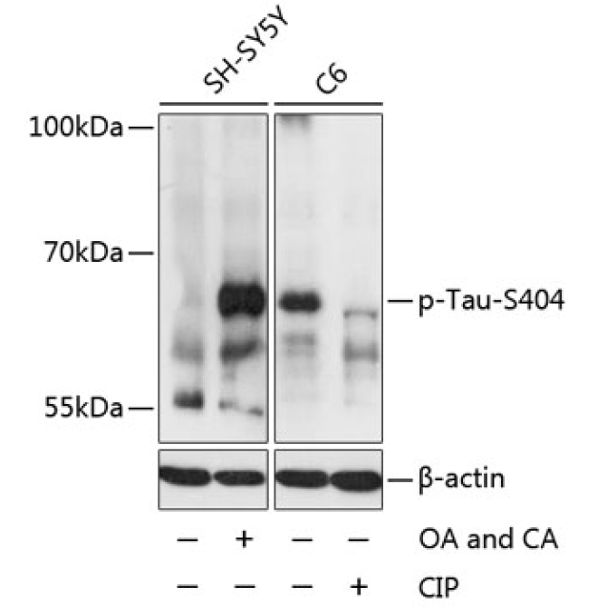 Phospho-Tau-S404 Rabbit Polyclonal Antibody