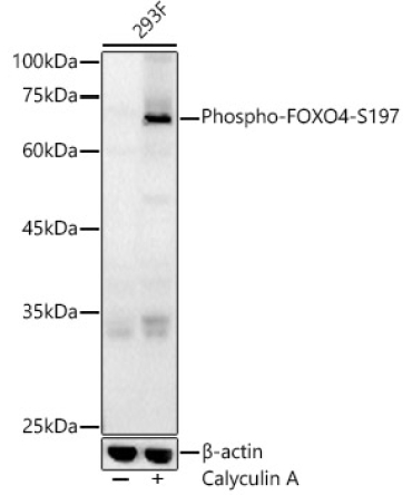 Phospho-FOXO4-S197 Rabbit Polyclonal Antibody