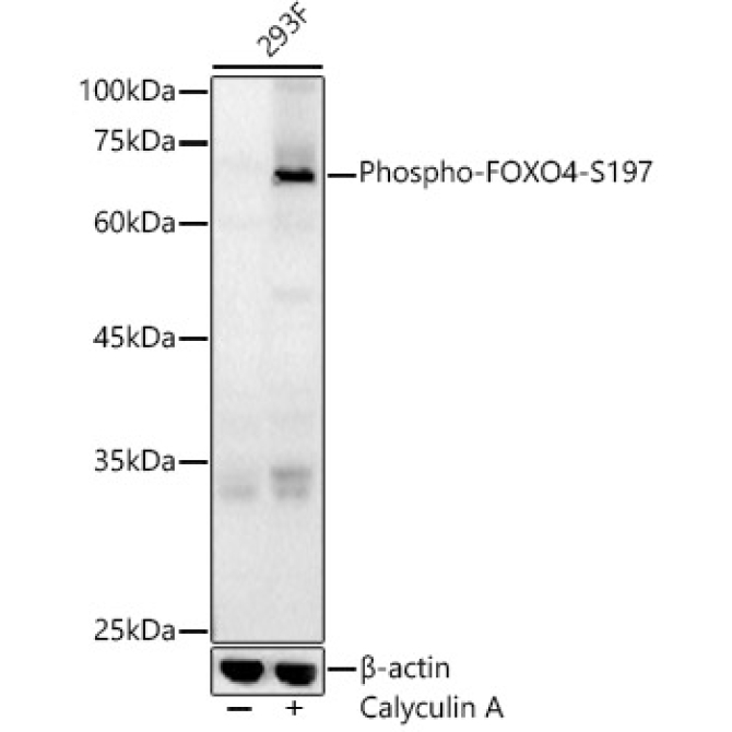 Phospho-FOXO4-S197 Rabbit Polyclonal Antibody