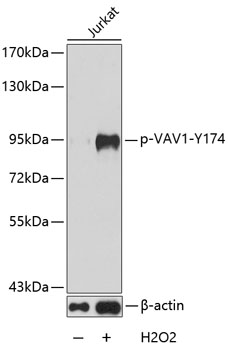Phospho-VAV1-Y174 Rabbit Polyclonal Antibody