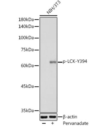 Phospho-LCK-Y394 Rabbit Polyclonal Antibody