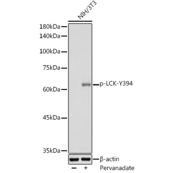 Phospho-LCK-Y394 Rabbit Polyclonal Antibody