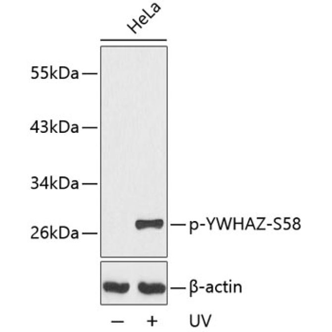Phospho-YWHAZ-S58 Rabbit Polyclonal Antibody