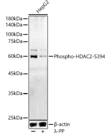 Phospho-HDAC2-S394 Rabbit Polyclonal Antibody