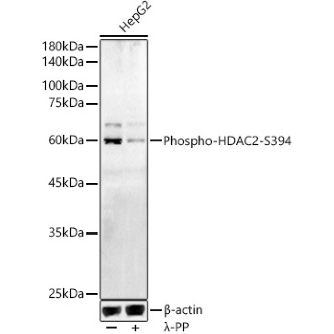 Phospho-HDAC2-S394 Rabbit Polyclonal Antibody
