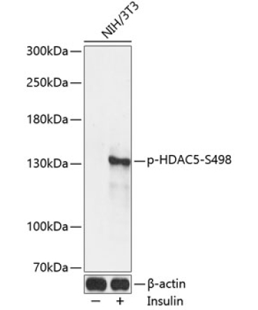 Phospho-HDAC5-S498 Rabbit Polyclonal Antibody
