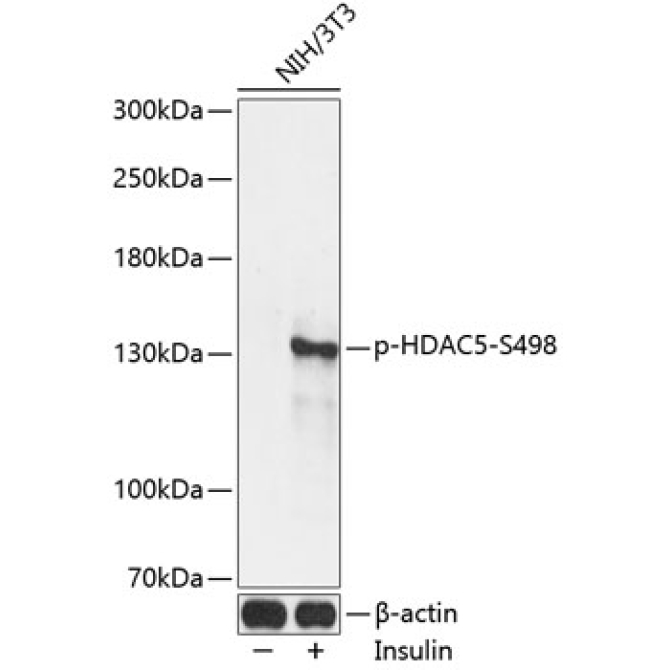 Phospho-HDAC5-S498 Rabbit Polyclonal Antibody