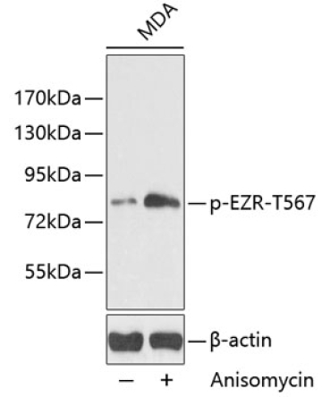 Phospho-Ezrin-T567 Rabbit Polyclonal Antibody