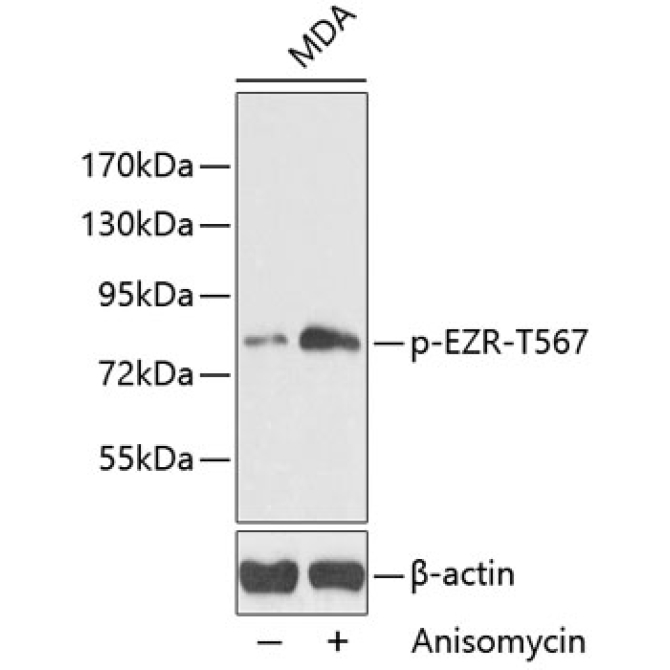 Phospho-Ezrin-T567 Rabbit Polyclonal Antibody